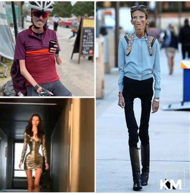 5 Skinniest People in the World