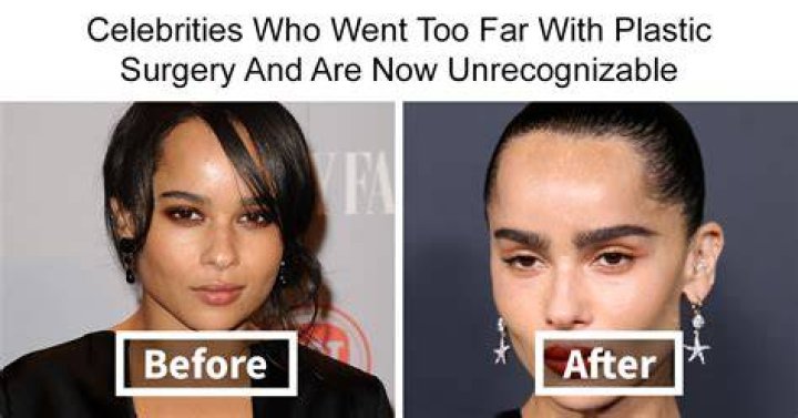 Does Himynamestee Have Kid? Before Plastic Surgery Photos Revealed On Reddit -Details To Know