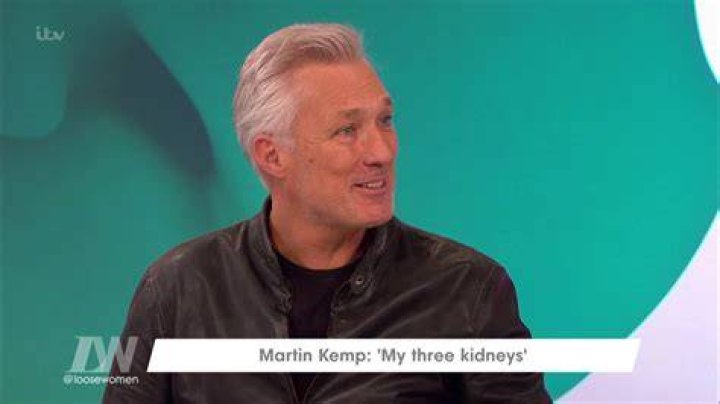 Is Martin Kemp deaf? Does Martin Kemp have 3 kidneys?