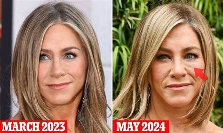 Jennifer Aniston Eye Color: Did She Undergo With Face Lift?